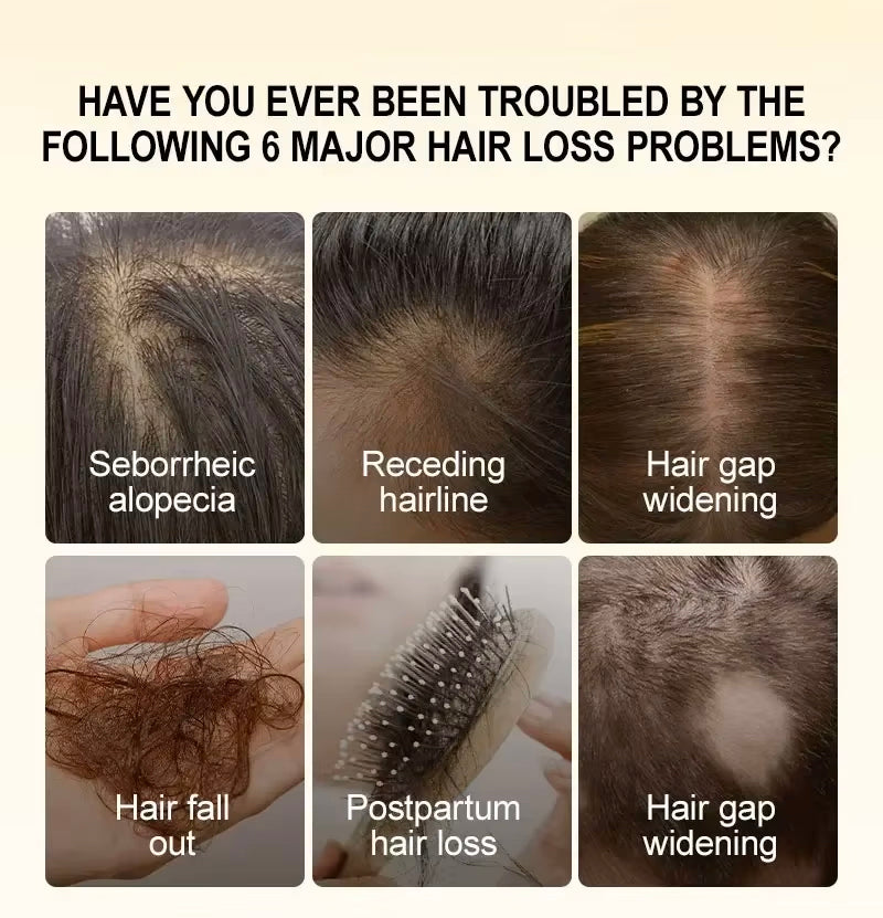 A promotional graphic with the headline 'HAVE YOU EVER BEEN TROUBLED BY THE FOLLOWING 6 MAJOR HAIR LOSS PROBLEMS?' above six labeled photos showing hair loss symptoms: seborrheic alopecia, receding hairline, hair gap widening, hair fall out, postpartum hair loss, and hair gap widening.