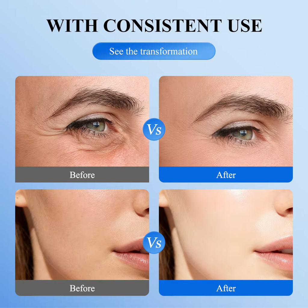 A before-and-after comparison graphic showing facial skin results under the text 'WITH CONSISTENT USE' and 'See the transformation.' The top row shows a close-up of an eye with wrinkles labeled 'Before' and smoother skin labeled 'After.